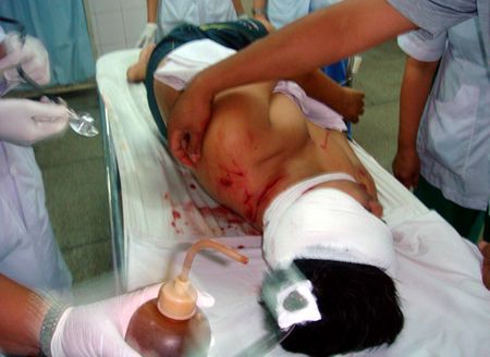 Nhân viên Giàu bị hổ tấn công được cấp cứu tại bệnh viện